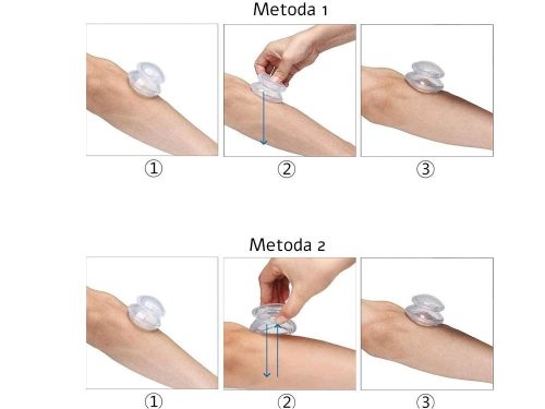 Köpöly masszázskészlet, 4 különböző méretű haranggal