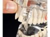 Implantátumos fogászati oktatómodell, 14 kivehető foggal